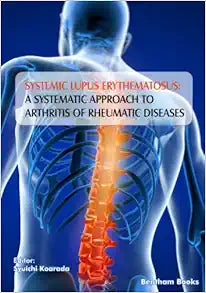 Systemic Lupus Erythematosus: A Systematic Approach to Arthritis of Rheumatic Diseases