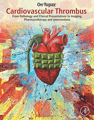 Cardiovascular Thrombus: From Pathology and Clinical Presentations to Imaging, Pharmacotherapy and Interventions