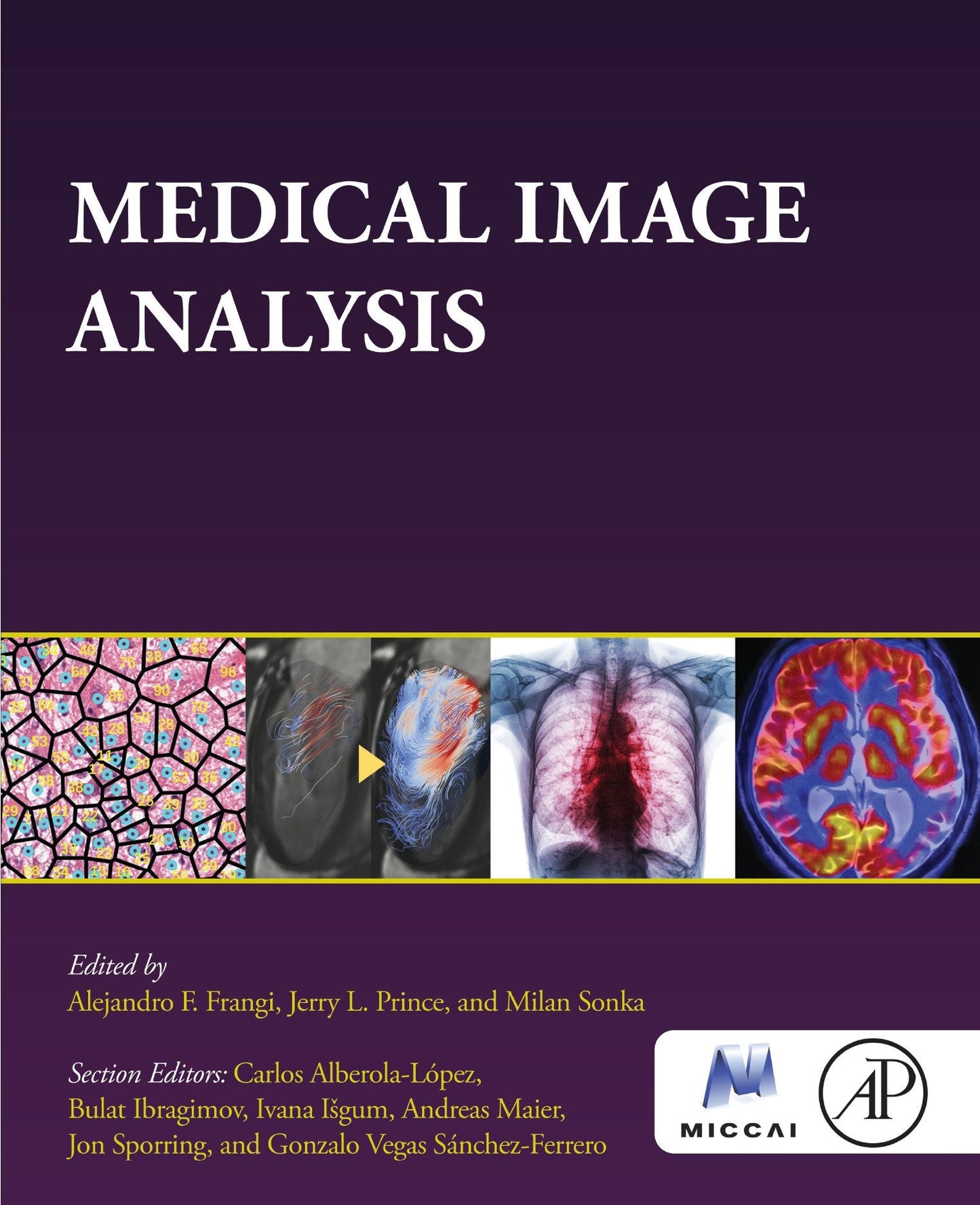 Medical Image Analysis (The MICCAI Society book Series)