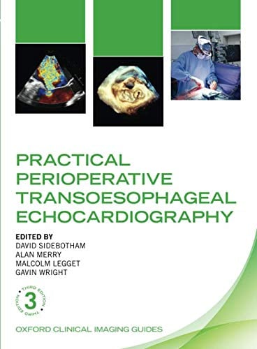 Practical Perioperative Transoesophageal Echocardiography , 3rd Edition