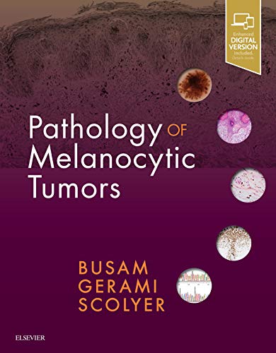 Pathology of Melanocytic Tumors (PDF)