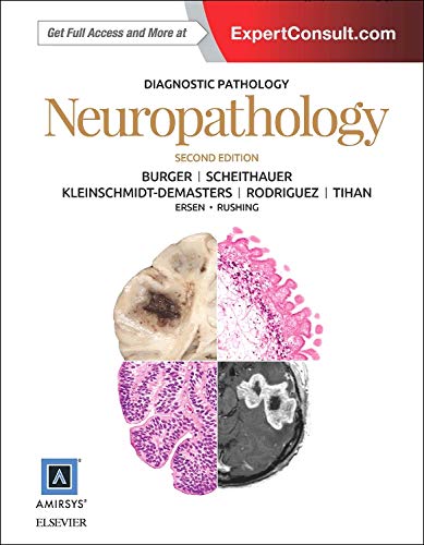 Diagnostic Pathology: Neuropathology, 2nd Edition (Original PDF from Publisher with High Quality Images)