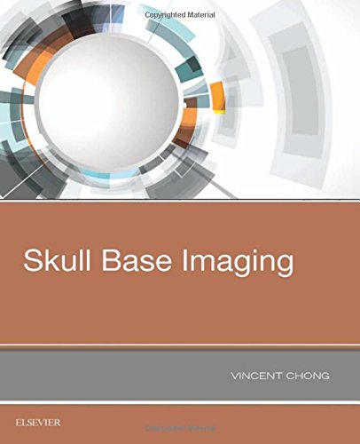 Skull Base Imaging, 1e (PDF)