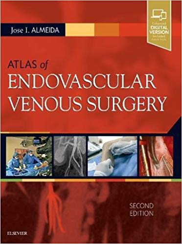 Atlas of Endovascular Venous Surgery, 2nd Edition (PDF)