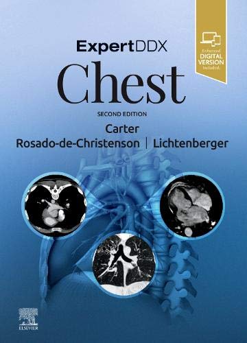 ExpertDDx: Chest, 2nd Edition