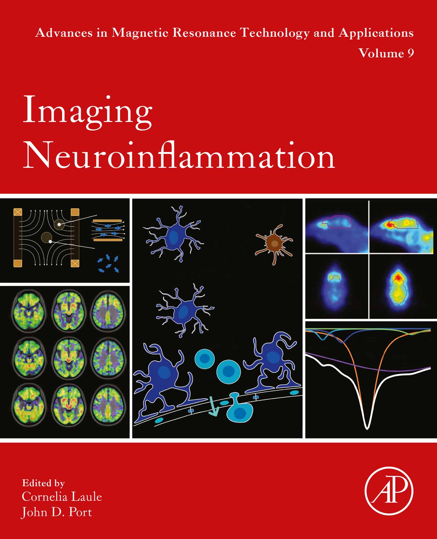 Imaging Neuroinflammation, Volume 9