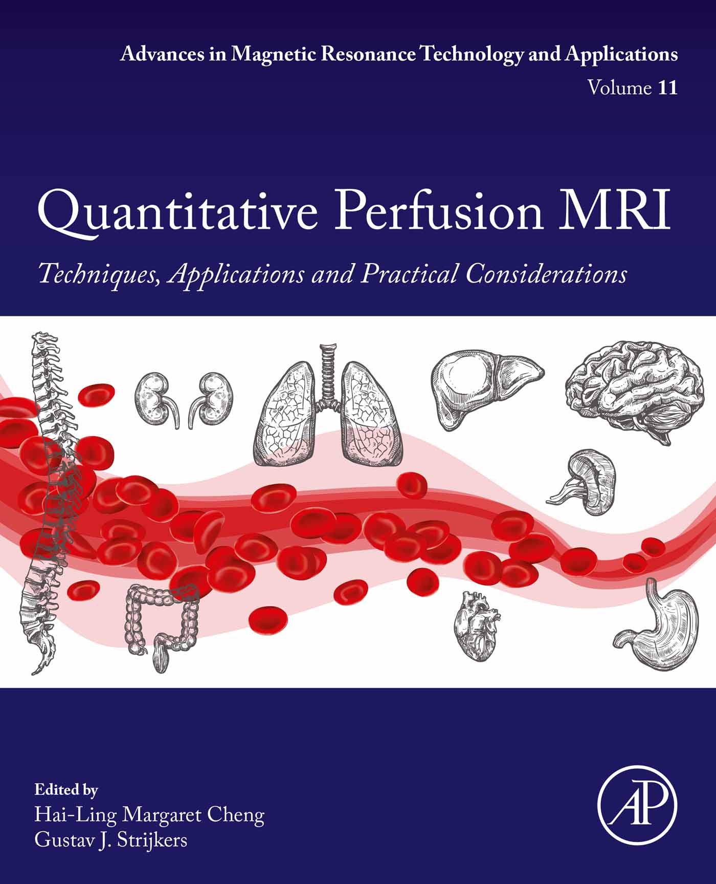 Quantitative Perfusion MRI: Techniques, Applications and Practical Considerations