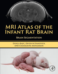 MRI Atlas of the Infant Rat Brain: Brain Segmentation
