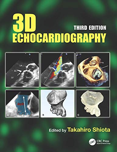 3D Echocardiography, 3rd edition