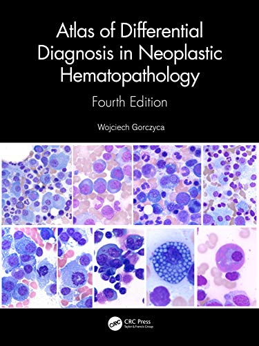 Atlas of Differential Diagnosis in Neoplastic Hematopathology, 4th Edition