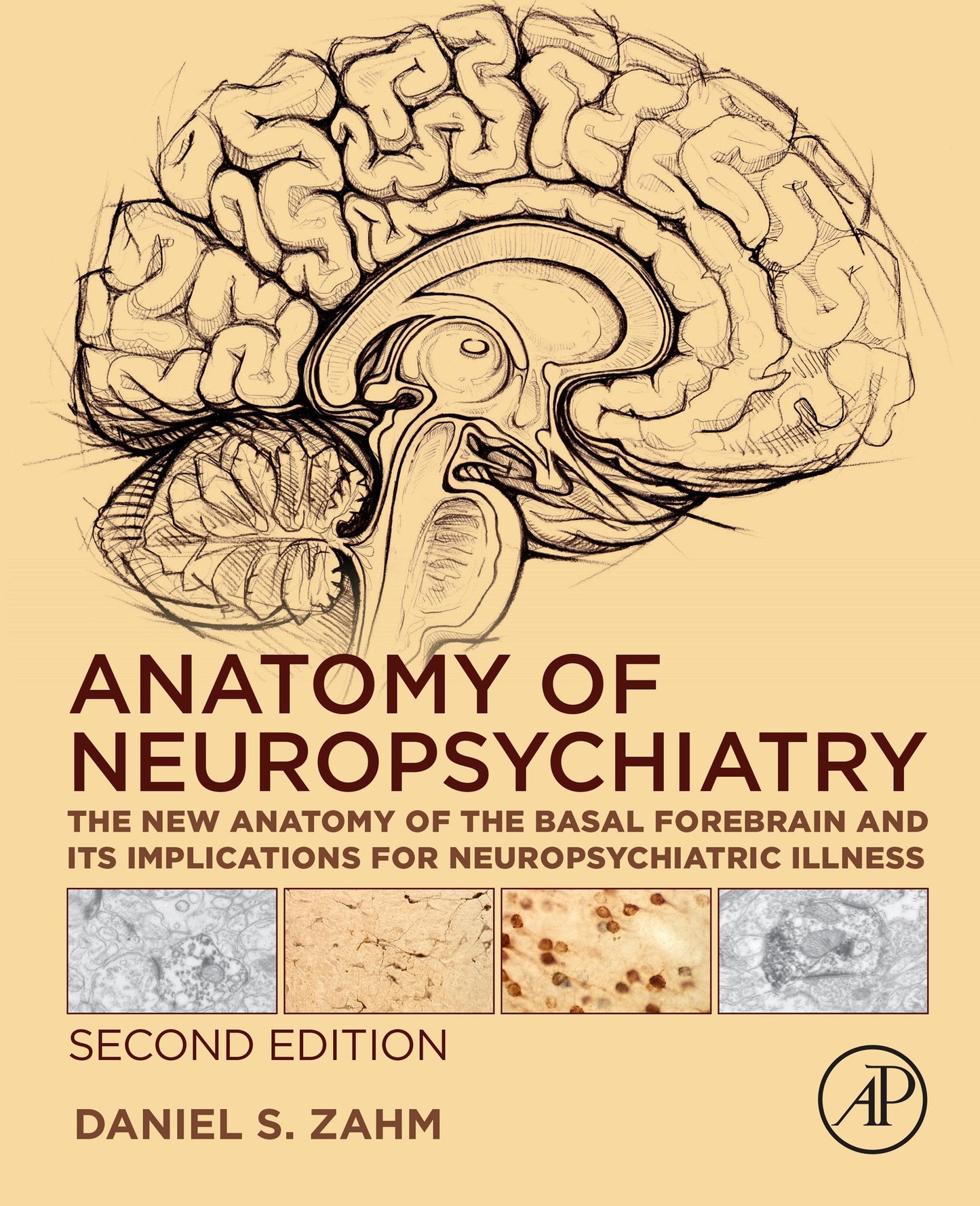 Anatomy of Neuropsychiatry: The New Anatomy of the Basal Forebrain and Its Implications for Neuropsychiatric Illness, 2nd Edition