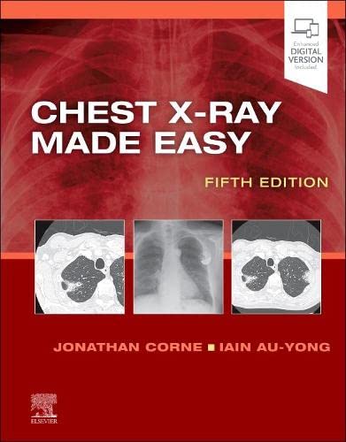 Chest X-Ray Made Easy, 5th edition