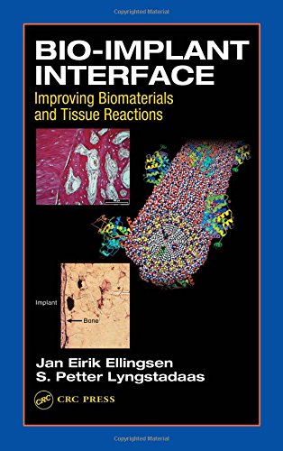 Bio-Implant Interface: Improving Biomaterials and Tissue Reactions