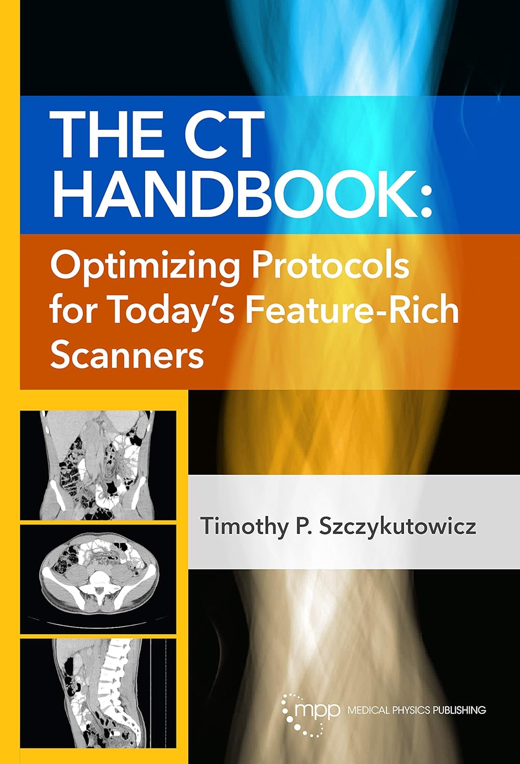The CT Handbook: Optimizing Protocols for Today’s Feature-Rich Scanners