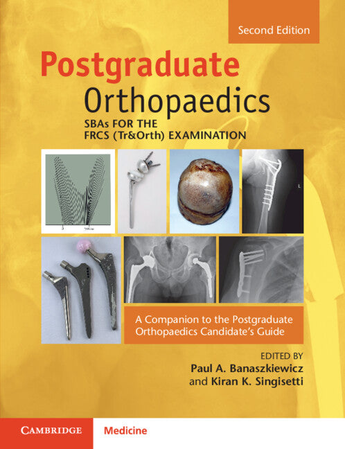 SBAs for the FRCS (Tr&Orth) Examination: A Companion to the Postgraduate Orthopaedics Candidate’s Guide 2e