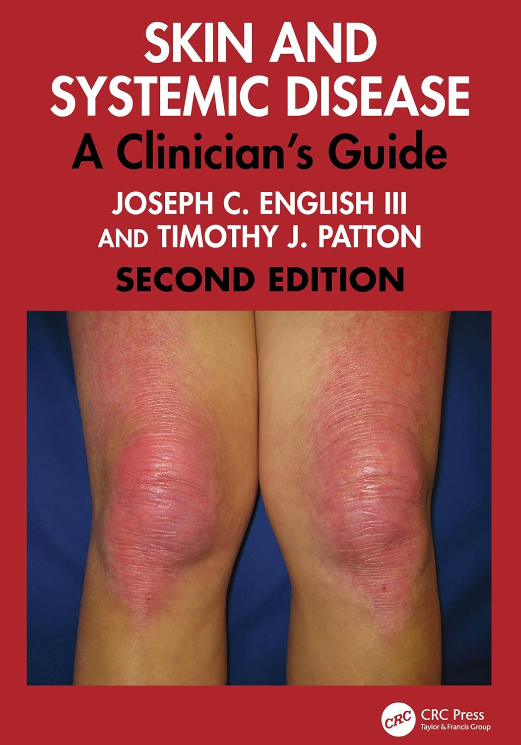 Skin and Systemic Disease: A Clinician’s Guide, 2nd Edition