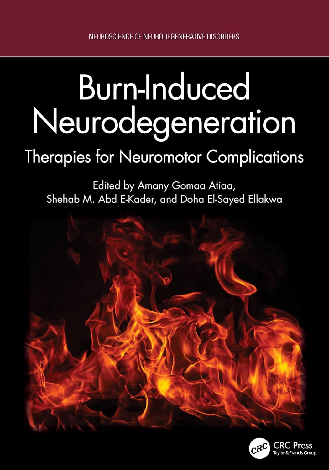 Burn-Induced Neurodegeneration: Therapies for Neuromotor Complications