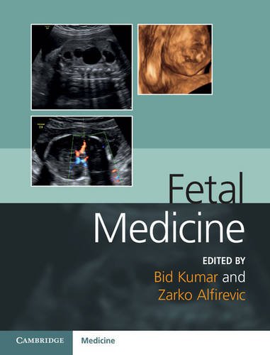 Fetal Medicine : 1st Edition