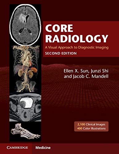 Core Radiology: A Visual Approach to Diagnostic Imaging, 2nd Edition
