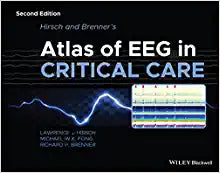 Hirsch and Brenner’s Atlas of EEG in Critical Care, 2nd Edition