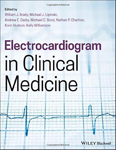 Electrocardiogram in Clinical Medicine