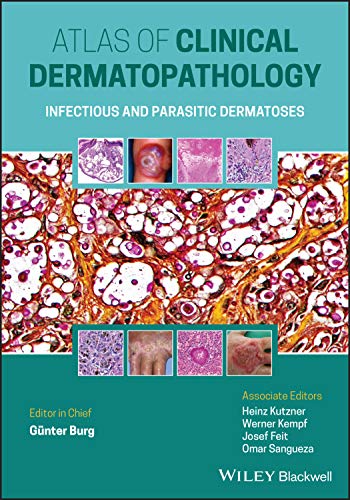 Atlas Clinical of Dermatopathology: Infectious and Parasitic Dermatoses