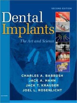 Dental Implants: The Art and Science, 2nd Edition