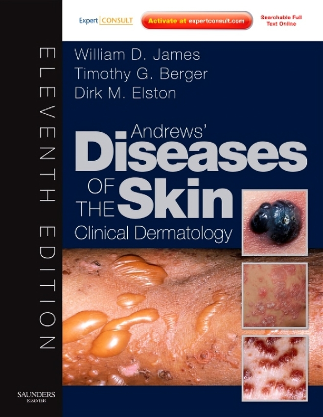 Andrews’ Diseases of the Skin: Clinical Dermatology, 11th Edition