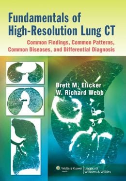 Fundamentals of High-Resolution Lung CT: Common Findings, Common Patterns, Common Diseases, and Differential Diagnosis (ORIGINAL PDF from Publisher)