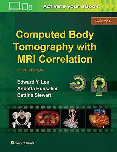 Computed Body Tomography with MRI Correlation, 5th Edition
