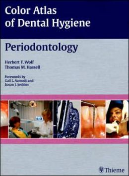Color Atlas of Dental Hygiene: Periodontology
