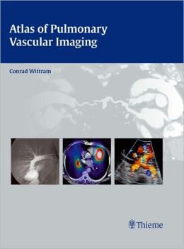 Atlas of Pulmonary Vascular Imaging: A Multimodality Approach