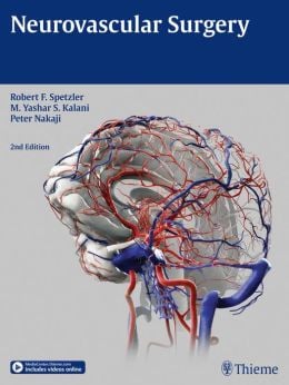 Neurovascular Surgery, 2nd Edition