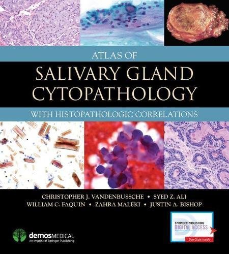 Atlas of Salivary Gland Cytopathology: with Histopathologic Correlations (PDF)