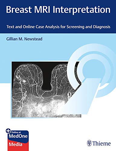 Breast MRI Interpretation: Screening and Diagnosis