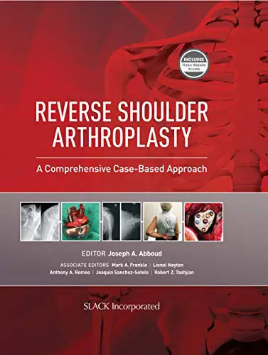 Reverse Shoulder Arthroplasty: A Comprehensive Case-Based Approach