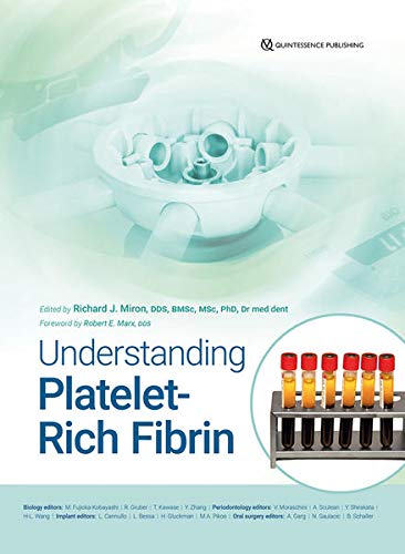 Understanding Platelet-Rich Fibrin