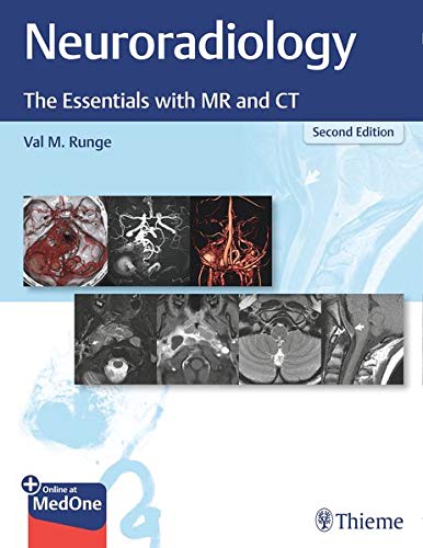 Neuroradiology: The Essentials with MR and CT, 2ed