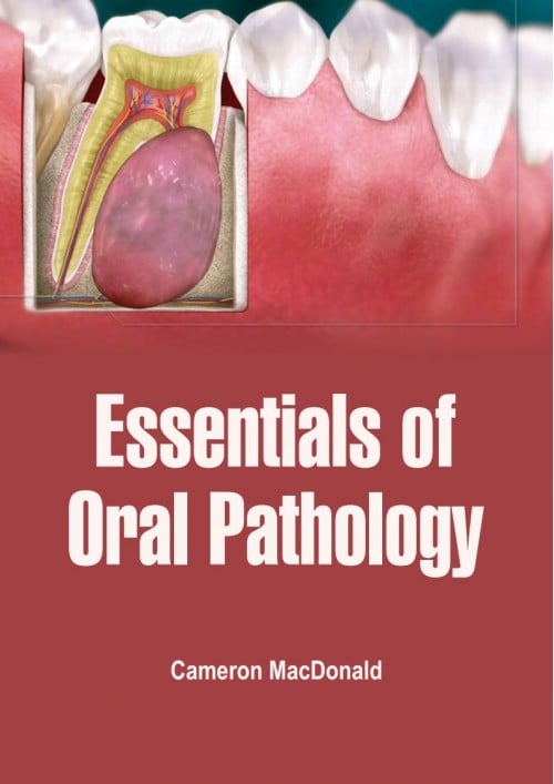 Essentials Of Oral Pathology