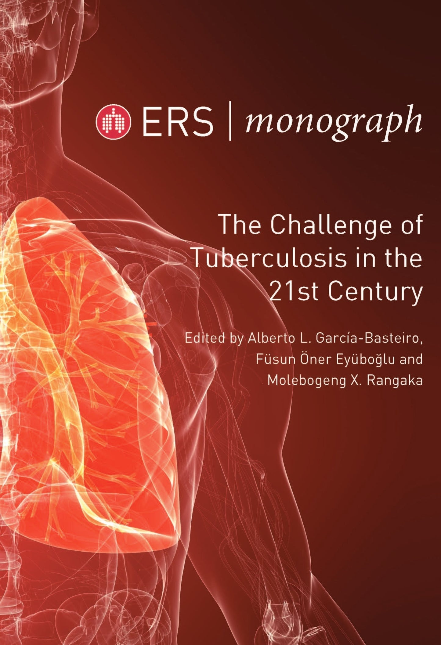 The Challenge of Tuberculosis in the 21st Century, 3rd Edition