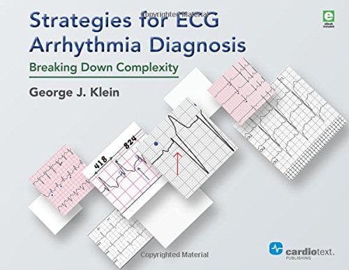 Strategies for ECG Arrhythmia Diagnosis: Breaking Down Complexity