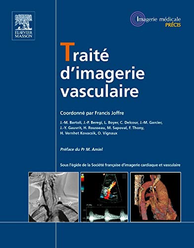 Traité d’imagerie Vasculaire (Imagerie médicale : Précis) (French Edition)