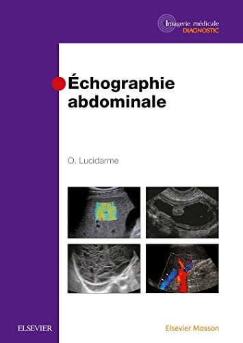 Echographie Abdominale (Imagerie Medicale Diagnostic) (French Edition)