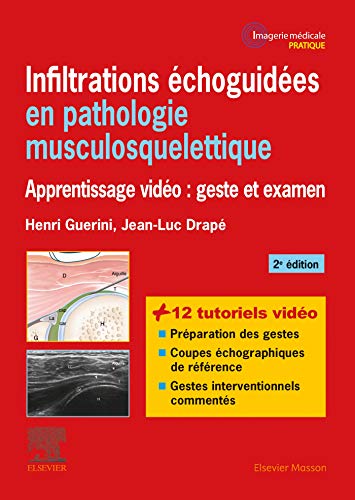 Infiltrations échoguidées en pathologie musculosquelettique: Apprentissage vidéo : geste et examen (Imagerie médicale : pratique) (French Edition)