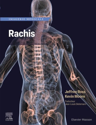 Imagerie médicale : Rachis
