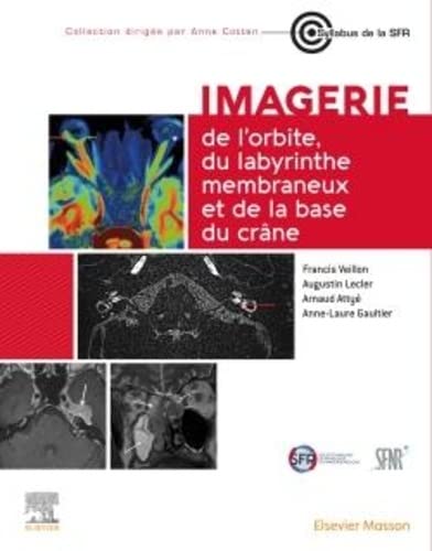 Imagerie de l’orbite, du labyrinthe membraneux et de la base du crâne