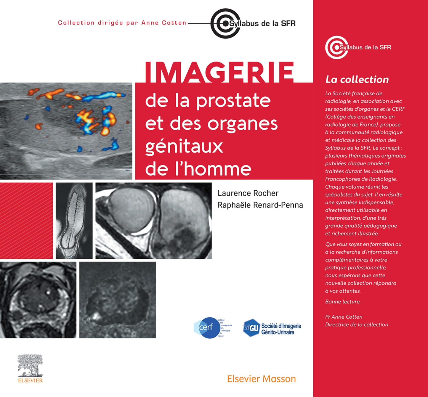 Imagerie de la prostate et des organes génitaux de l’homme