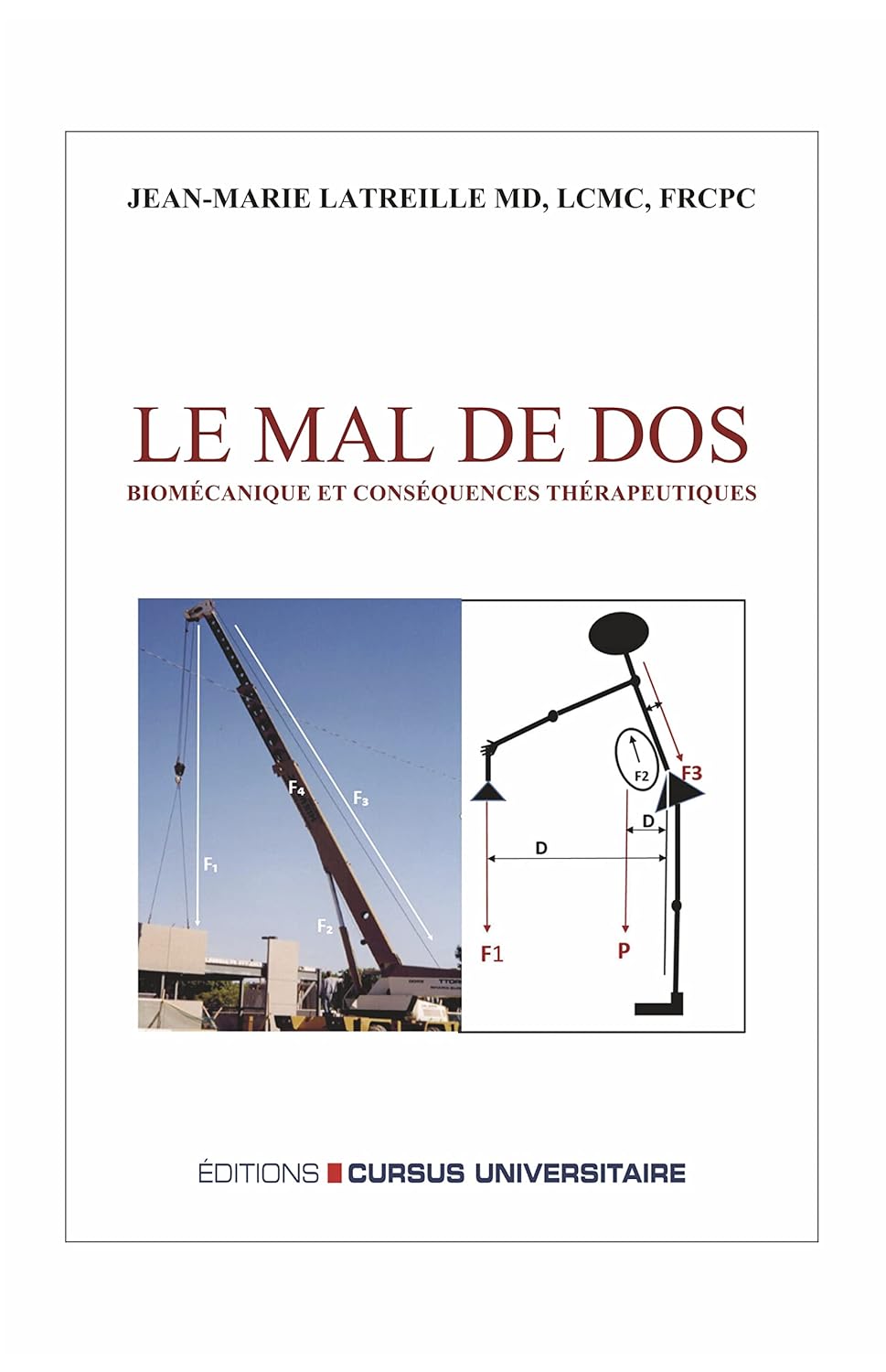 Le mal de dos: Biomécanique et conséquences thérapeutiques – 2ème édition revue et augmentée (French Edition)