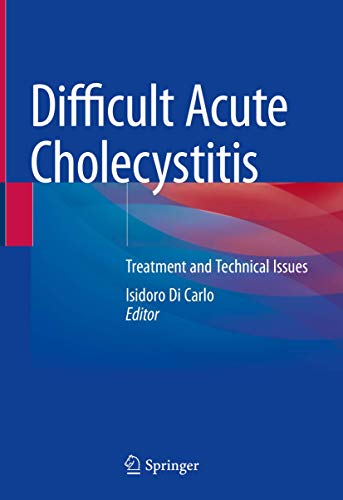 Difficult Acute Cholecystitis: Treatment and Technical Issues