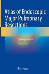 Atlas of Endoscopic Major Pulmonary Resections (3rd ed.)